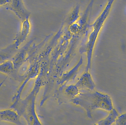 Stammzellen aus Nabelschnurgewebe