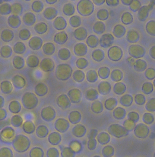 Stammzellen aus Nabelschnurblut sichern